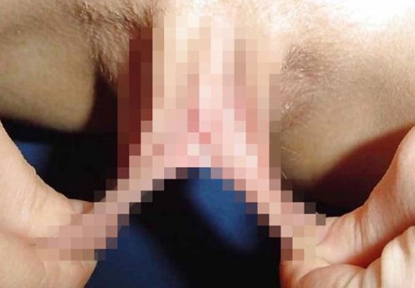 【小陰唇エロ画像】これぞヤリマンの証!?小陰唇伸びすぎだろwww肥大化したビラビラをご覧くださいwww その【小陰唇エロ画像】これぞヤリマンの証!?小陰唇伸びすぎだろwww肥大化したビラビラをご覧くださいwww その10